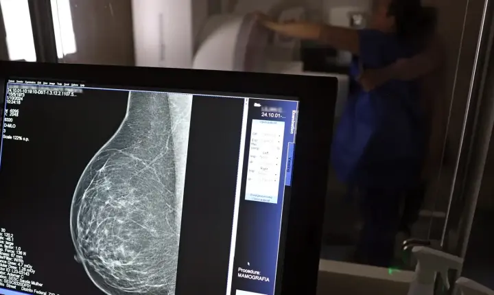 Plano de saúde terá que cobrir mamografia digital para todas as idades